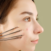 کربوکسی-تراپی